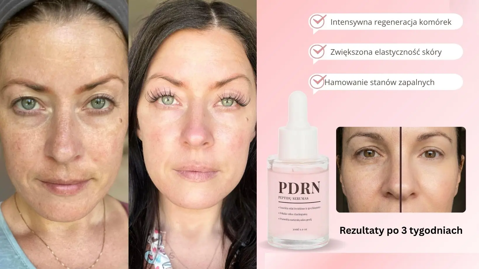 Wygląd skóry po regularnej pielęgnacji serum PDRN